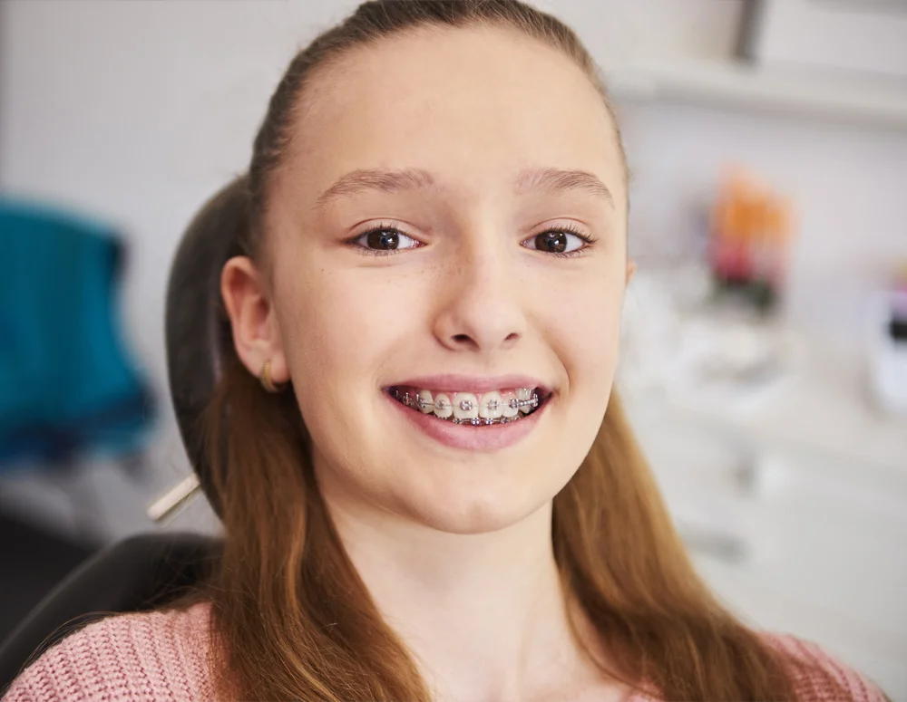 orthodontic-treatments-before-after https://yoursmileturkey.com/wp-content/uploads/2023/03/orthodontic-treatments-before-after.webp